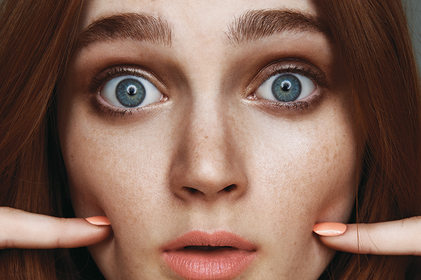 Everything you need to know about freckles