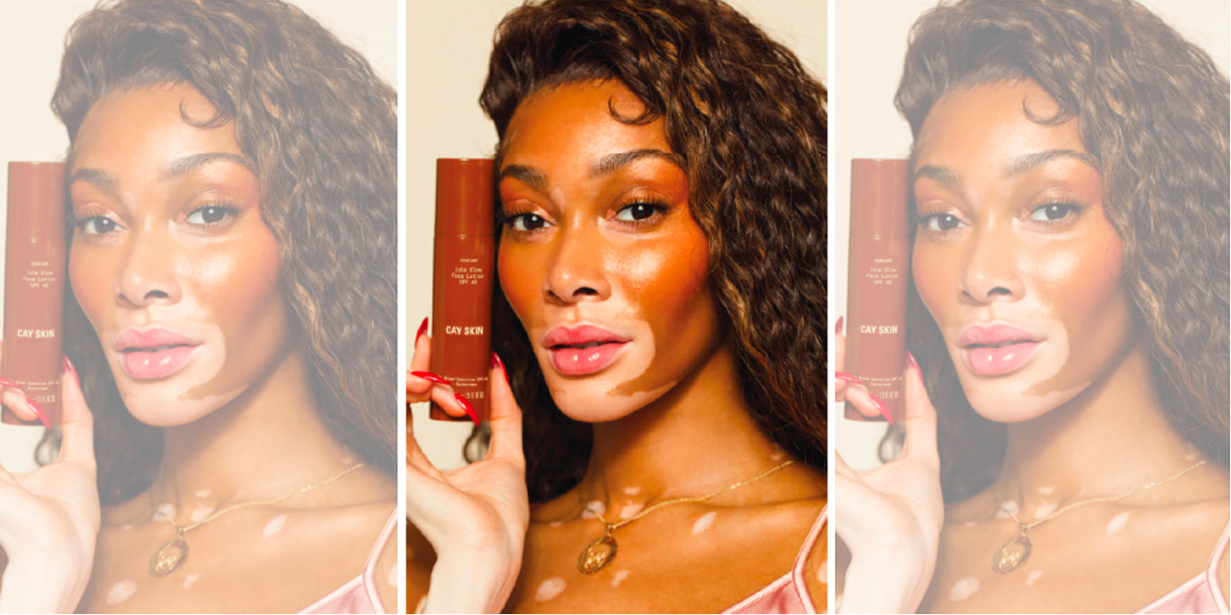 Winnie Harlow's Cay Skin Launches in Canada