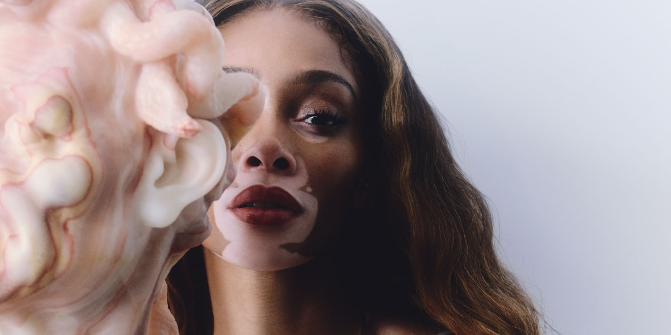 Winnie Harlow wows in sexy bra as she lands first Elle Canada cover
